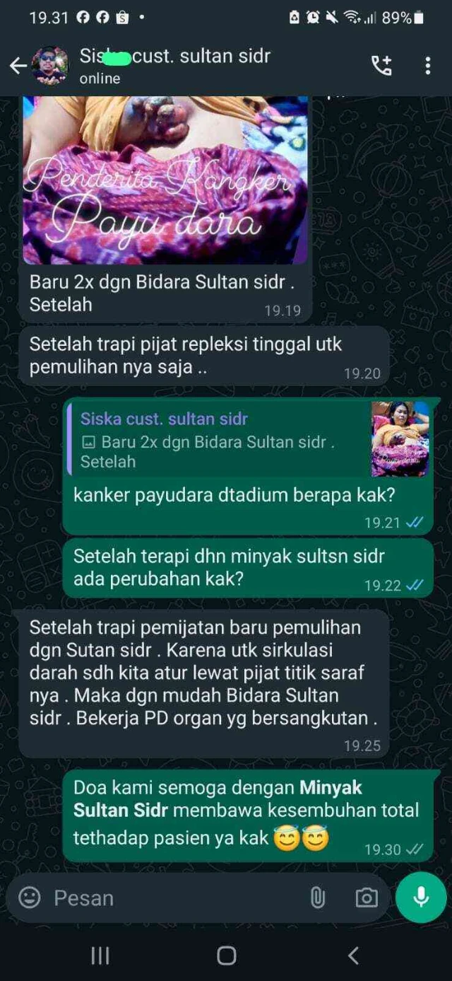 1744612490732-01 Kanker PD.webp