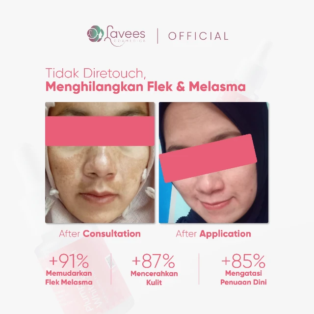 1732212874936-Salinan Shopee Shop_Plumpy8