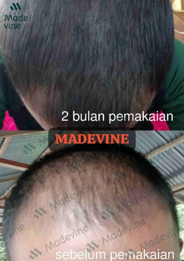 1743137026395-TESTIMONI-MADEVINE-JUOS-compressed-1-724x1024