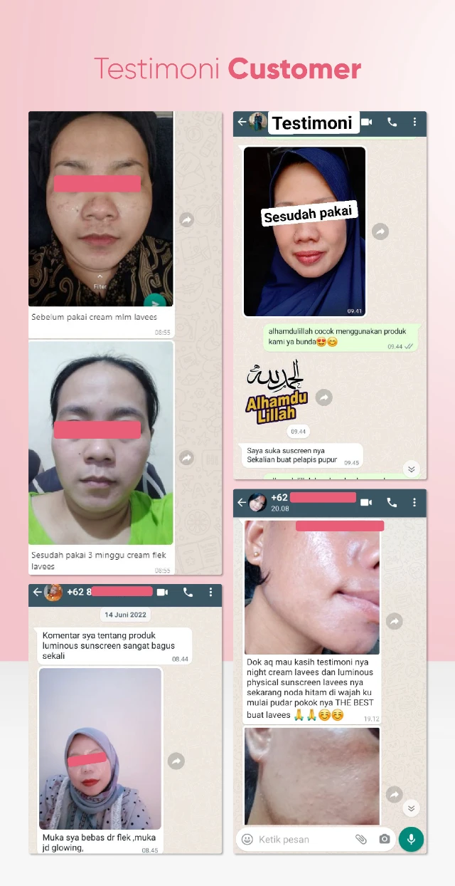 1732212569685-Luminous V29