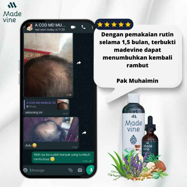 1743136955596-image-0-compressed-1