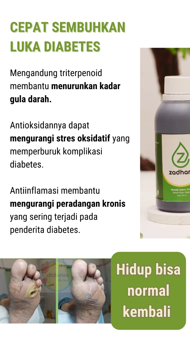 1731730630784-Harapan baru bagi penderita diabetes kronis (11)