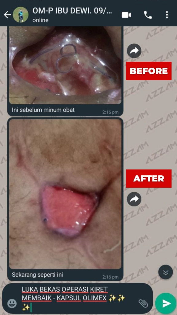 1710305194067-Testimoni-Olimex-3-576x1024