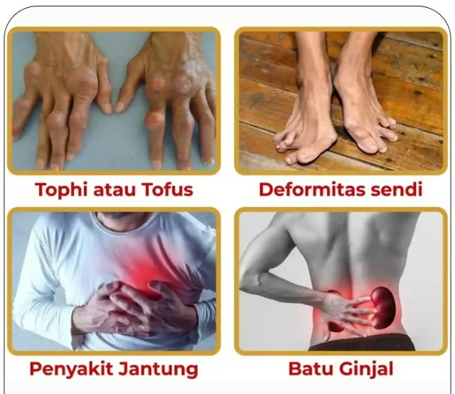 1755536544219-CmAA3b6ubPA9f7ACmAUxtIYyy4ePDQRgupCBcxbJ9aQ