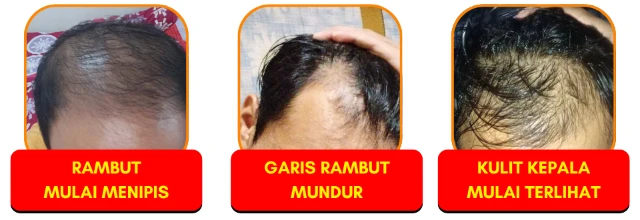1759908846419-keluhan rambut madevine