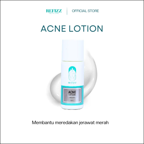 Refizz Acne Lotion