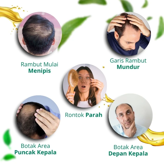 1754551026282-folikel (1)