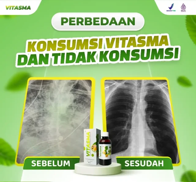 1758332323568-04_GHIFARI_02DG_VTSPERBEDAANKONSUMSI_MURDO_OKT-1024x951-1