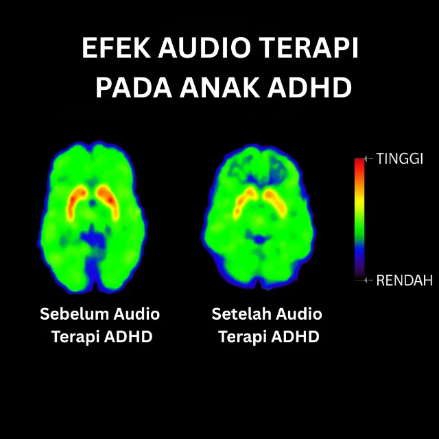 1761615343319-IKLAN ADHD 35 