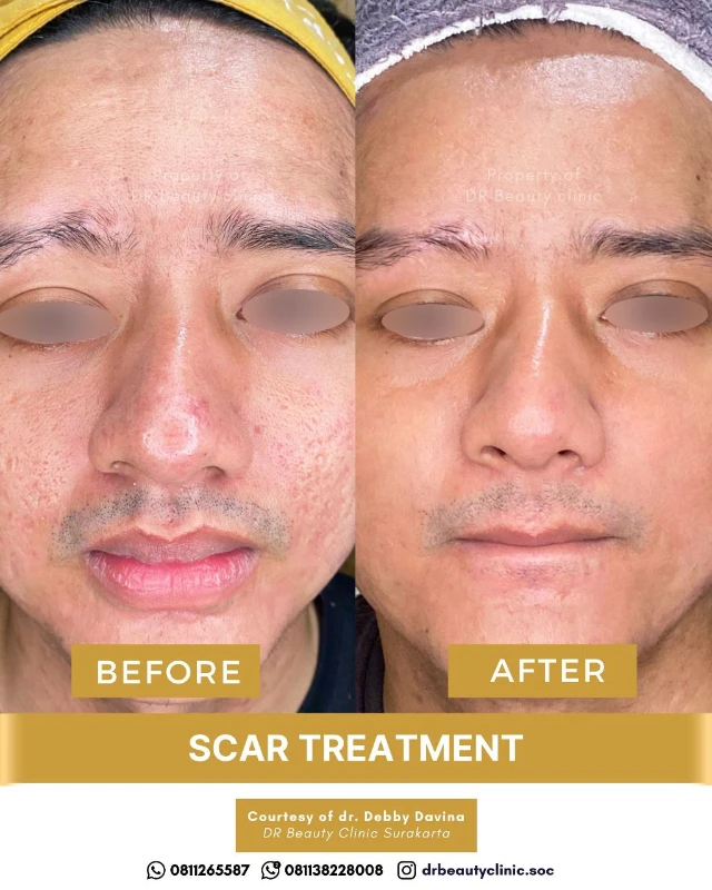 1762417898428-3BA Scar 6 Nov (2)