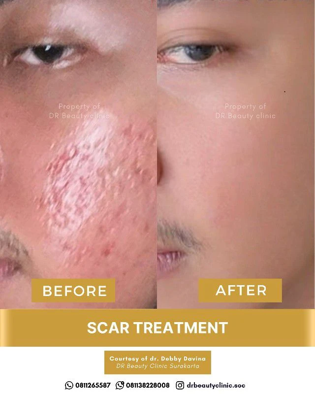 1762417917908-BA Scar 6 Nov (1)