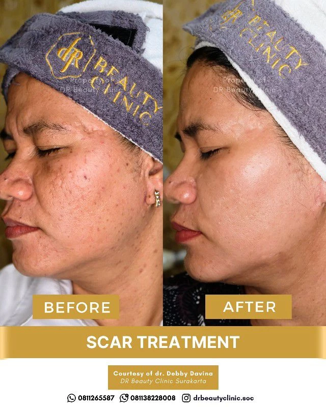 1762417939672-BA Scar 6 Nov (4)