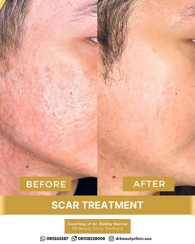 1762417947606-BA Scar 6 Nov (5)