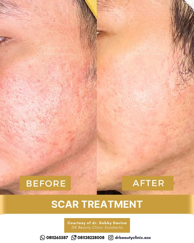 1762417959222-BA Scar 6 Nov (6)