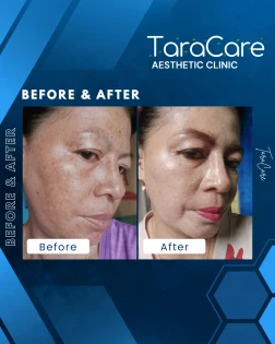 testimony-https://cdn.scalev.id/uploads/1763092272/lsaDSQtBZPhd64nsfkJNEw/1763092272200-t1.webp