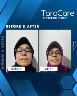 testimony-https://cdn.scalev.id/uploads/1763092336/4EgxTdWBPqGqn7Tzv2T7VQ/1763092336056-tt2.webp