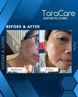 testimony-https://cdn.scalev.id/uploads/1763092382/-v4dtNYkX7c54lIaqvQcDA/1763092382320-tt3.webp