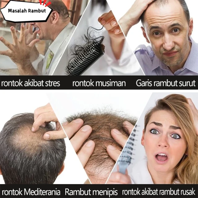 1764043923566-id-11134207-7r98o-lzzw0vnytfize7-1