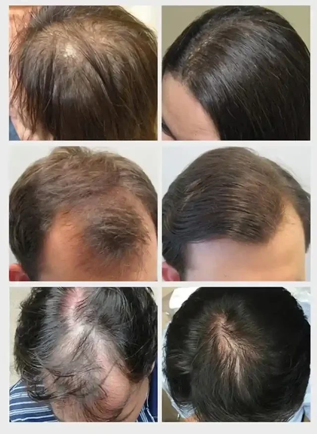 1764045059113-WhatsApp-Image-2024-12-02-at-19.34.25_11zon_13_11zon-e1733168958510-1