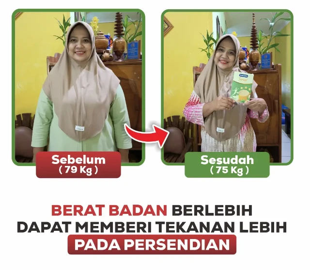 1765247197404-2_before after