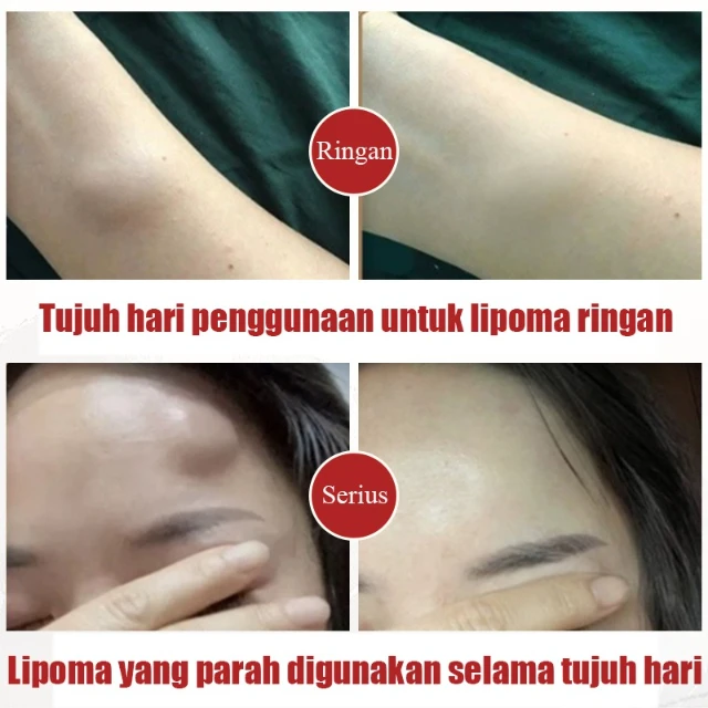 1765249169046-CxACXwiSTWayLUZCxAR7SmQaoC7oHSNCpDVevBKKrDg