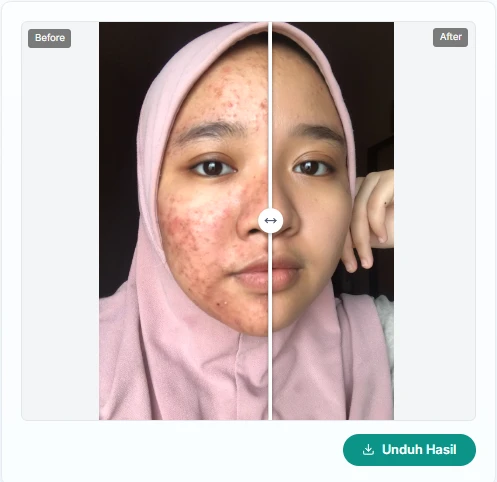 1767987589118-RETOUCH A