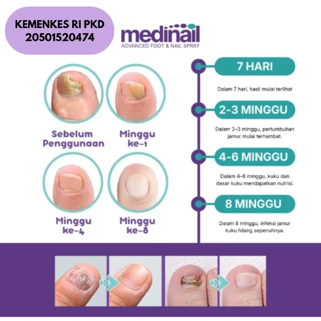 Banner Keunggulan Medinail