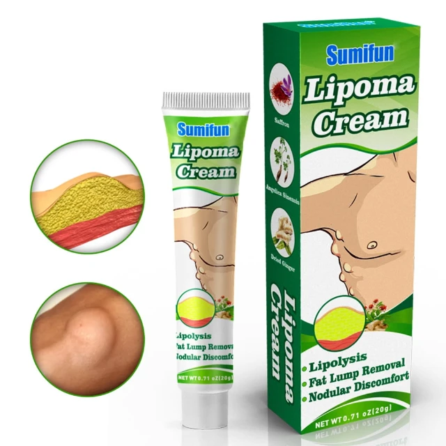 Lipoma Cream Salep Benjolan