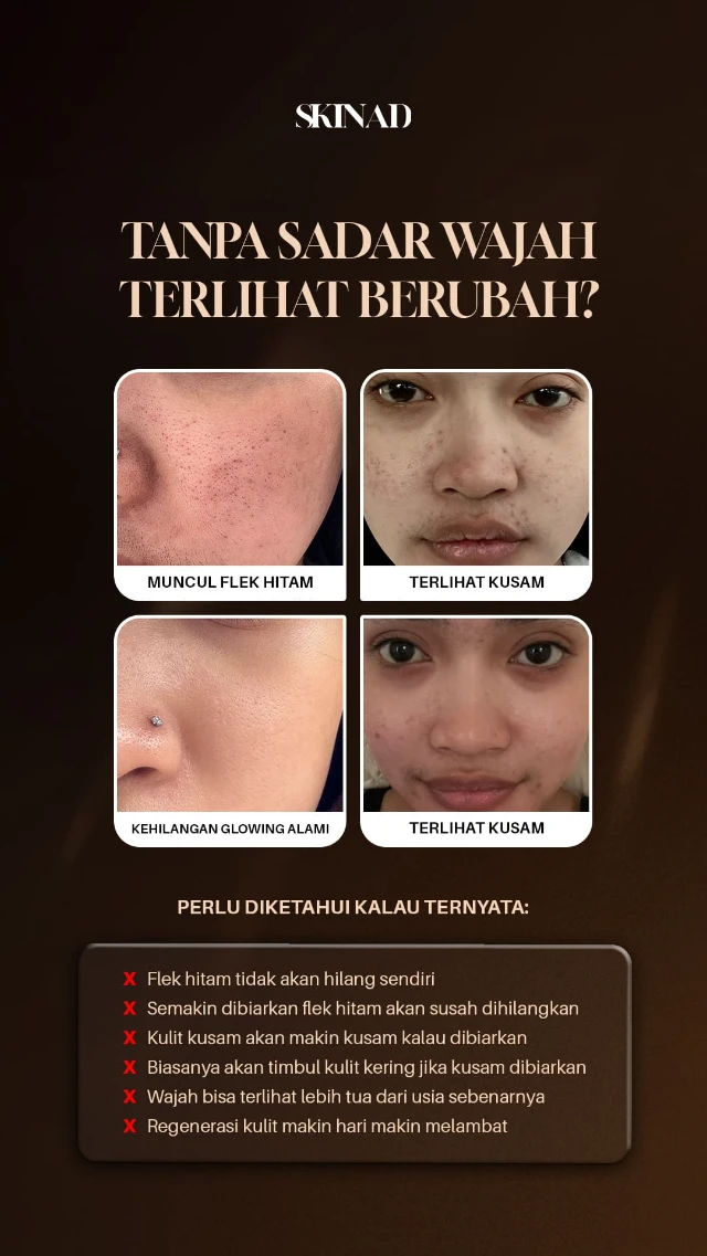 1773295014570-Tanpa-sadar-wajah-terlihat-berubah