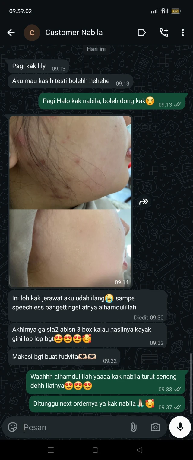 1775695626619-WhatsApp Image 2026-04-02 at 15.25.33 (1).webp