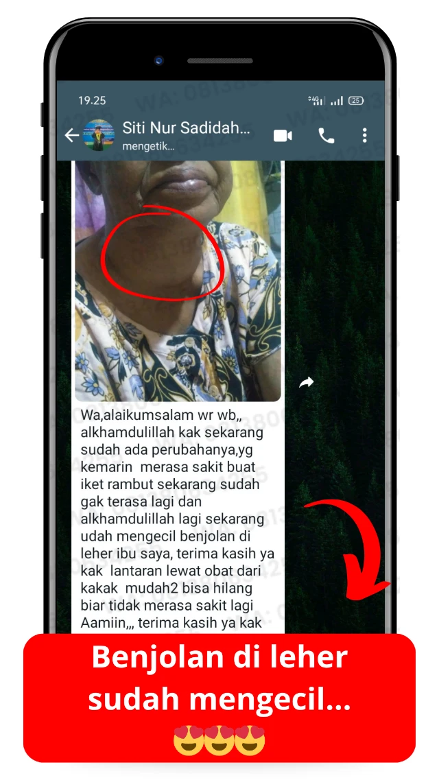 Testimoni OILIFE
