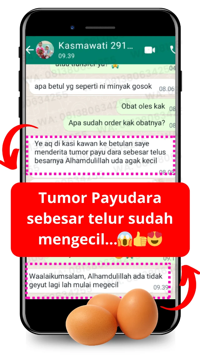 Testimoni OILIFE