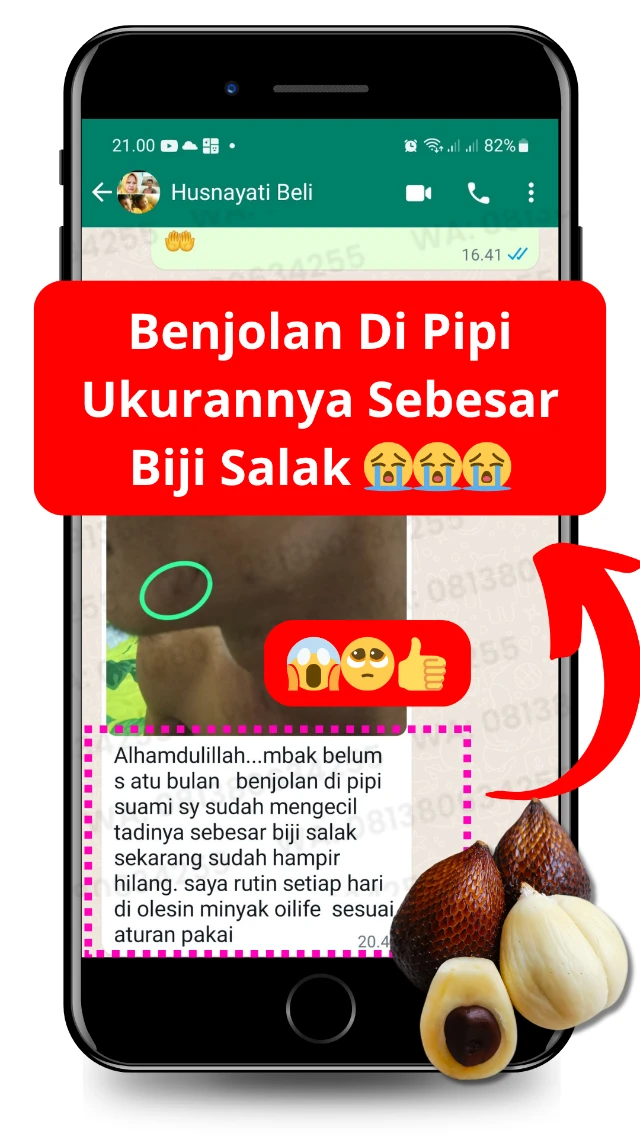 Testimoni OILIFE