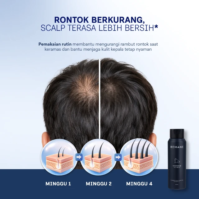 ThickPower Shampoo Before After Journey