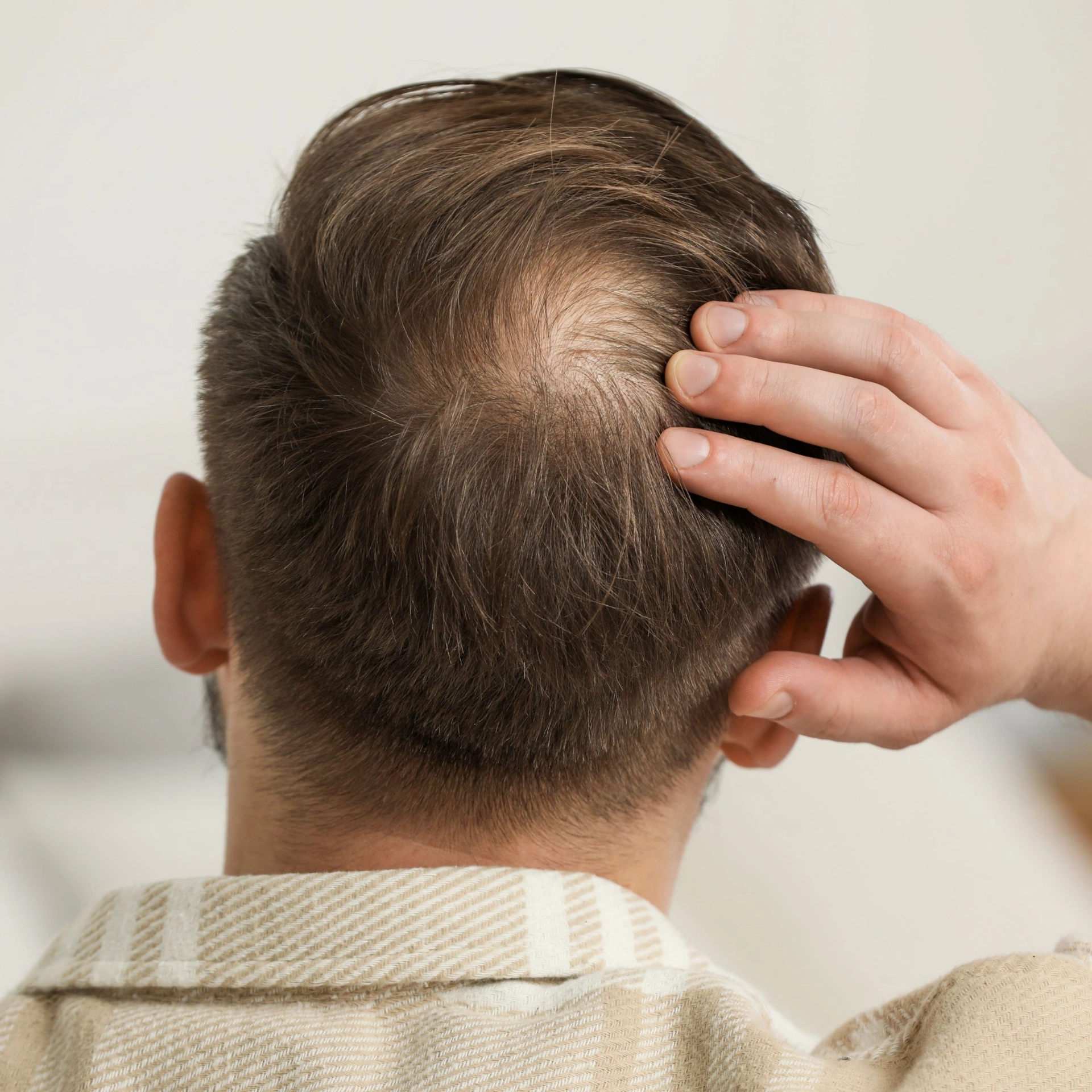 Pria dengan rambut menipis di bagian atas