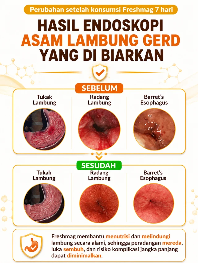 1778832016379-LP - PERUBAHAN 3 - CHATGBT